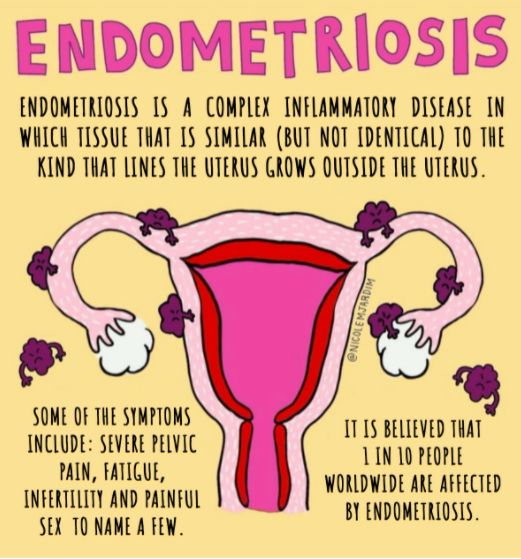 Period Pain: Should I Be Worried?